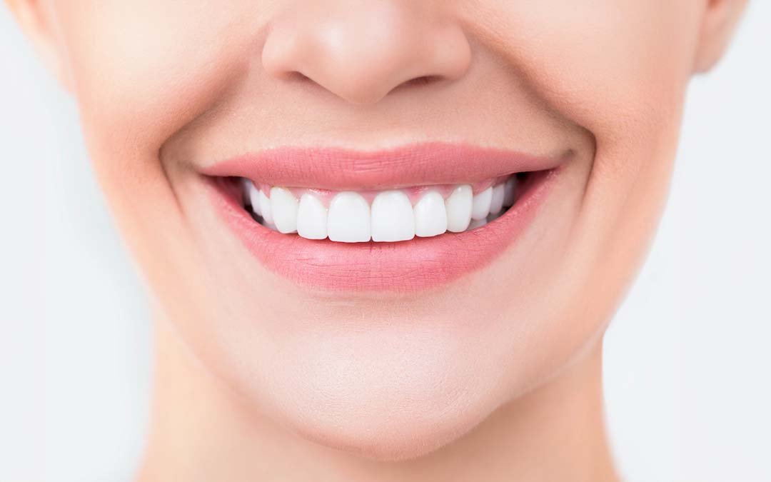 Come l'Implantologia trasforma il tuo sorriso - Studio dentistico Giuva